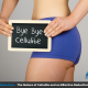 Cellulite reduction with effective fitness training